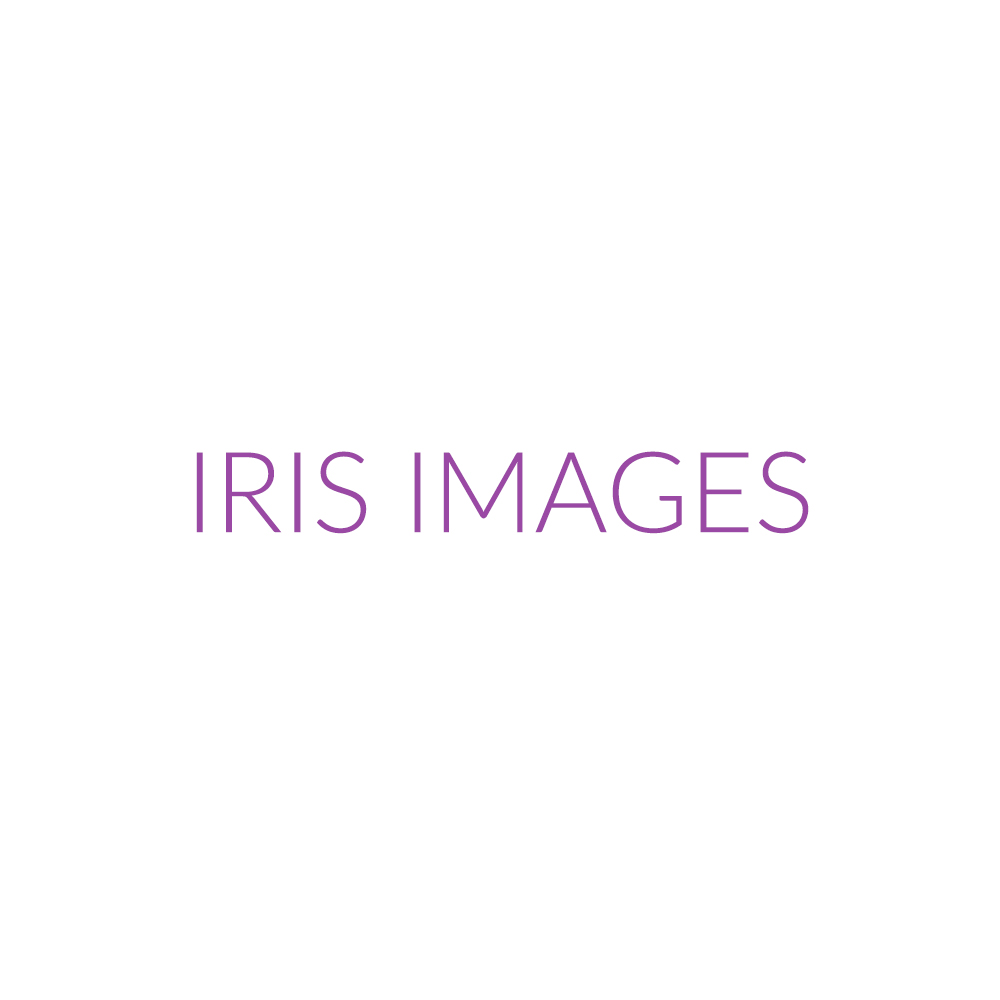 IRIS IMAGES